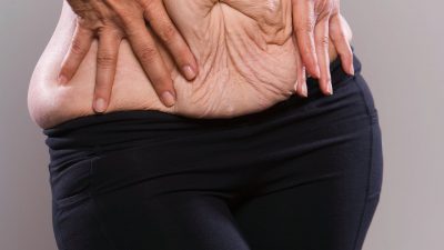 Veel mensen zonder obesitas kopen Ozempic zonder recept, maar weten niet wat er met hun gezicht, borsten en buikwand gaat gebeuren